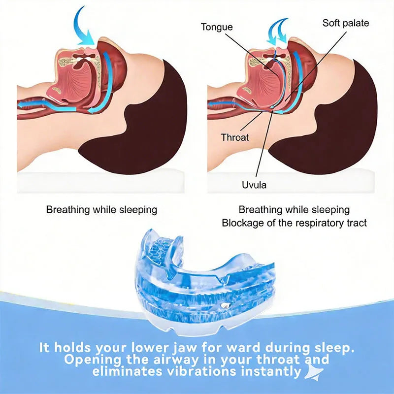 Adjustable Anti Snoring Mouth Guard for Night Relief