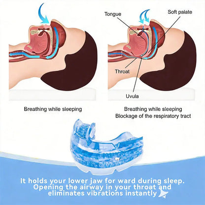 Adjustable Anti Snoring Mouth Guard for Night Relief